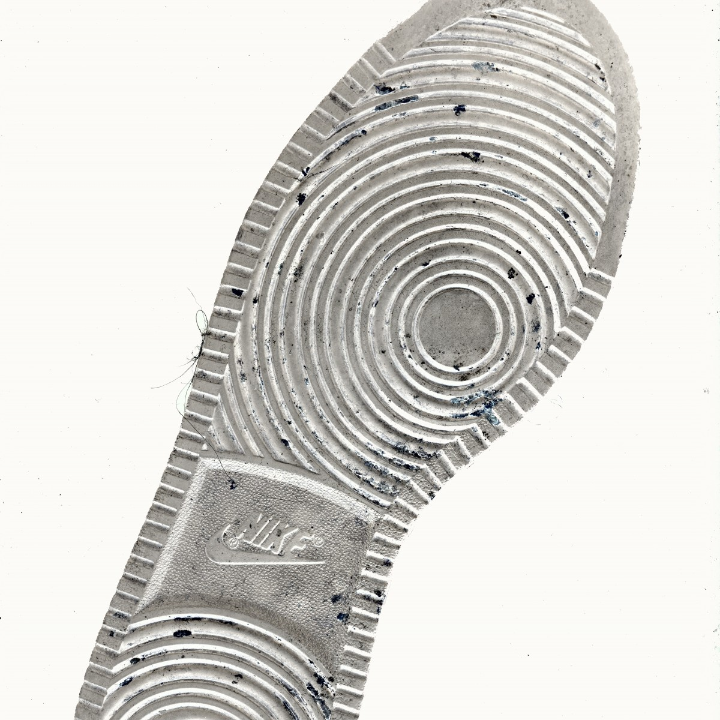 impresion dental con alginato