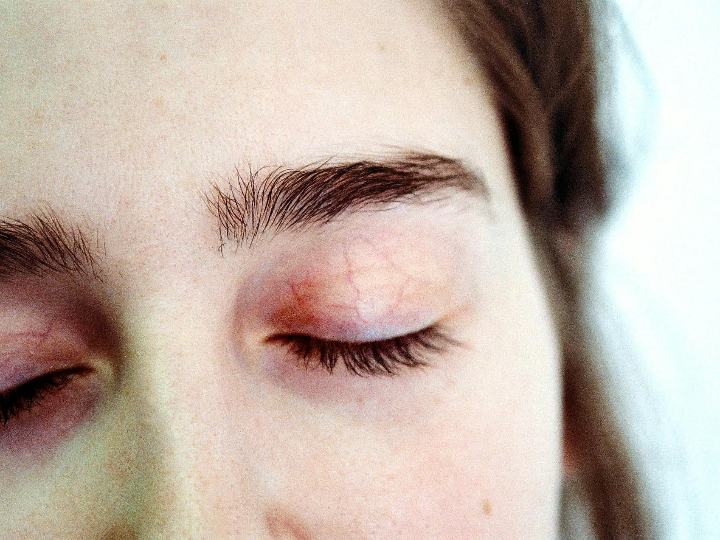 singuladerm xpert collageneur eye contour 15 ml contorno de ojos